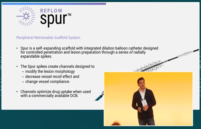 Infrapopliteal revascularisation - Retrievable scaffold therapy (RST) with an innovative lesion preparation device in conjunction with DCB: an endovascular solution